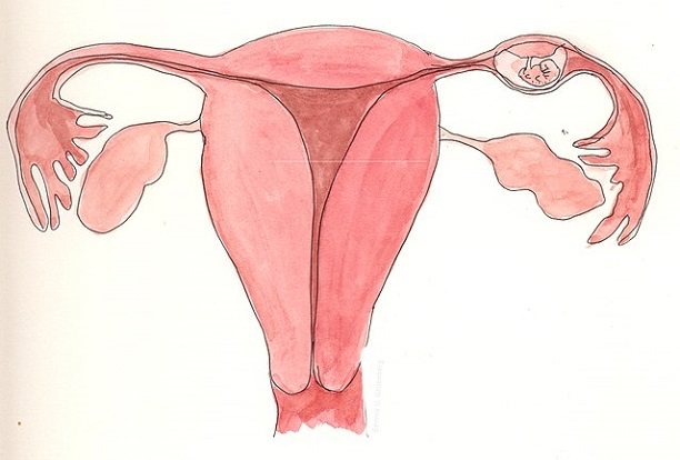 Внематочная беременность: первые признаки на раннем сроке и можно ли обойтись без операции