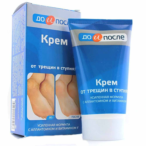 До и после Крем для ног от трещин 150 мл